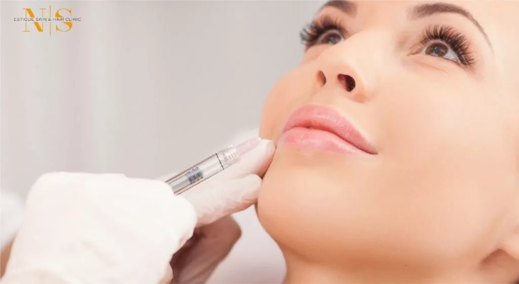 Facial Dermal Fillers Treatment in Gurgaon